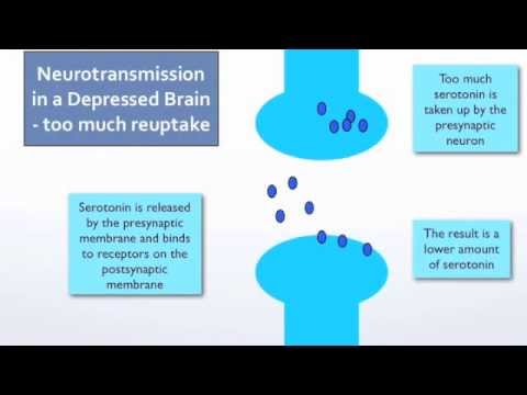 how to treat ssri overdose