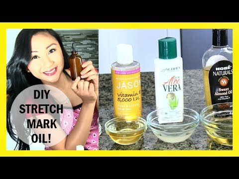 how to apply vitamin e oil on stretch marks