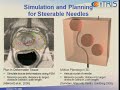 Steerable Needles