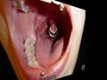 Piercings - akik a piercinget szeretik !