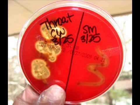 how to isolate serratia marcescens