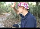 Oral Herpes CureMovie Part 2 Lidocaine Viscous