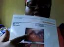 Tonsilectomy and more Tonsils/Tonsillectomy