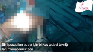 Gökhan Özerdem-63