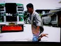 polio man walks on his knees