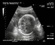 baby-in-womb