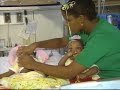 NJN News Healthwatch Report - Conjoined Twins