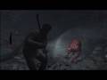 Silent Hill 5: Zombie Rampage Gameplay