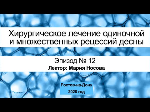 Лечение рецессии десны Часть 12. Ростов-на-Дону 2020 год