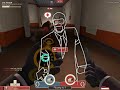 Spycrab Cap FTW