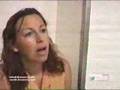 Pregnant-arm-amputee
