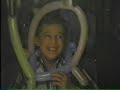 Butterflies: The Children of Ichthyosis -Views : 3
