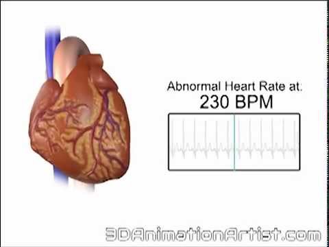 how to improve resting heart rate