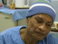 Der indonesische Baummann wird behandelt Der indonesische Baummann wird behandelt