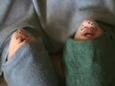 Yogurt Chins 4