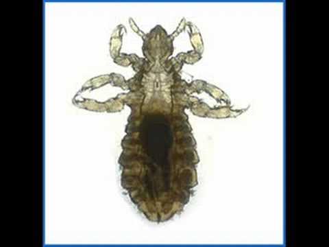 how to treat house for lice