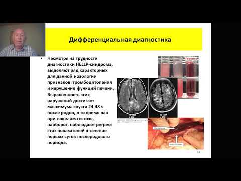 Видео: BjQ92C-hgw0