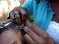 The fundamental basics of treebraiding and crochet braids
