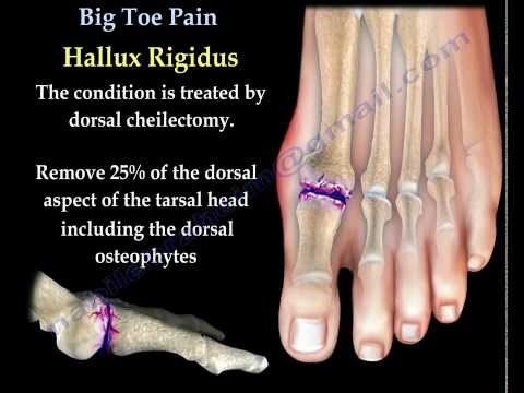 how to relieve big toenail pain