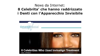 8 Celebrità che hanno raddrizzato i denti con l'Apparecchio Invisibile