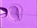 FIV - Fertilização in vitro FIV - Fertilização in vitro