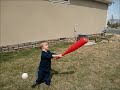 Down syndrome:&nbsp;Down Syndrome toddler playing Baseball