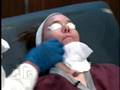 Acne Laser Treatment