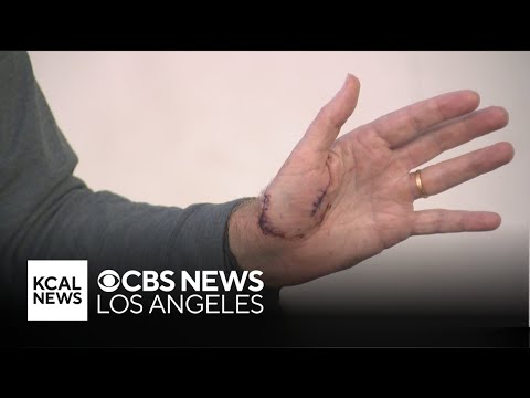 Il nuotatore parla di attacco di squalo al largo di Catalina Island Coast | Notizie Kcal Il nuotatore parla di attacco di squalo al largo di Catalina Island Coast | Notizie Kcal