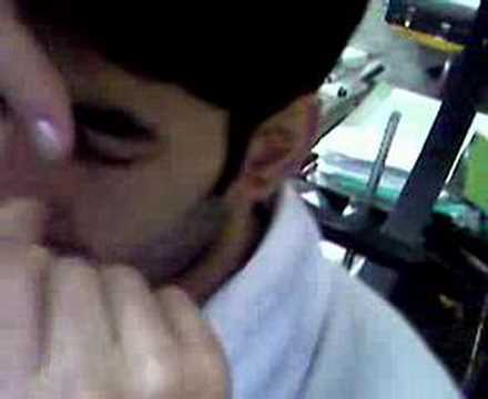 Ophthalmology Practice(conjuntiva 1)