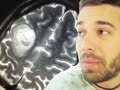 ITS NOT A TUMOR (WAIT IT IS)... (2.24.12 - Day 1030)