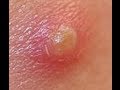 Skin Emergency - Top 3 Tips and Tricks