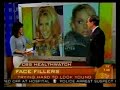 Plastic Surgery New York - CBS Early Show - Cosmetic Fillers - Darrick Antell MD Plastic Surgery New York - CBS Early Show - Cosmetic Fillers - Darrick Antell MD