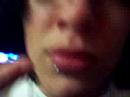 Flaring Nostrils.