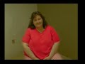 1 Week after Mini-Gastric Bypass