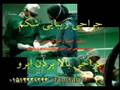 abdominoplasty and blepharoplasty