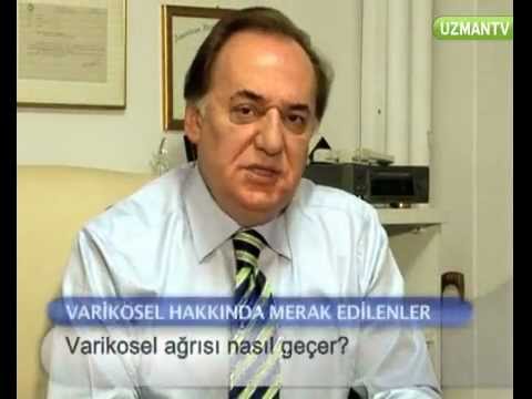 Varikosel 0 Varikosel