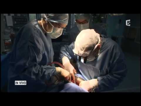 tabac - Chirurgie d'un poumon malade à cause de la cigarette.