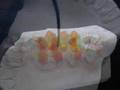 Enceramento Progressivo