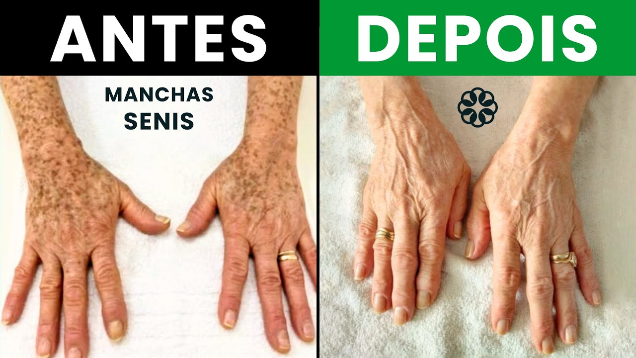 Cida - Cliente de Americana - Cima's Estética