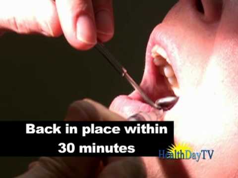 how to treat avulsed tooth