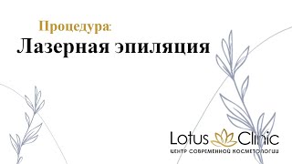 Лазерная эпиляция