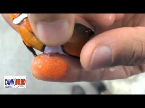 how to relieve bloating after egg retrieval
