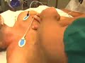 cold-war-kids-hospital-beds.html