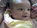 baby cute kena picit hidung