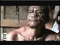 Hombre �rbol