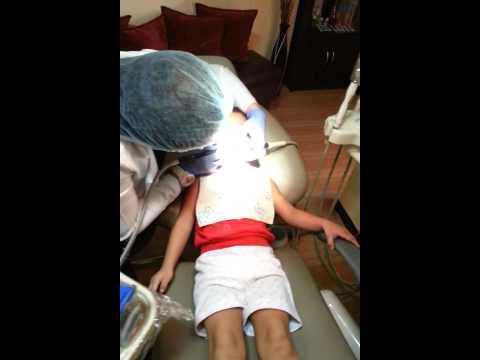 dental fetish - Dental filling.