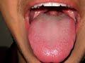 Mouths of Max & Norbert