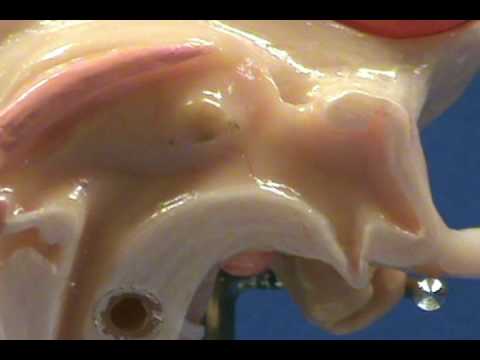 Anatomy and Physiology: Hypothalamus, Optic Nerve, Third Ventricle ... Anatomy and Physiology: Hypothalamus, Optic Nerve, Third Ventricle ...