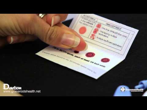 how to test for vit d'level