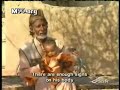 سبحان الله - طفل له ذيل